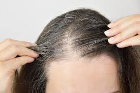 How Can Hair Restoration Help Me?