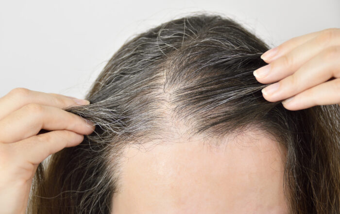 Things To Know About Effective Hair Loss Treatments